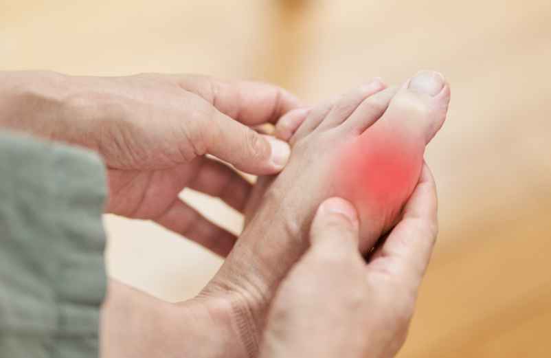 Crise de goutte et consommation de Coca-Cola : comprendre les risques